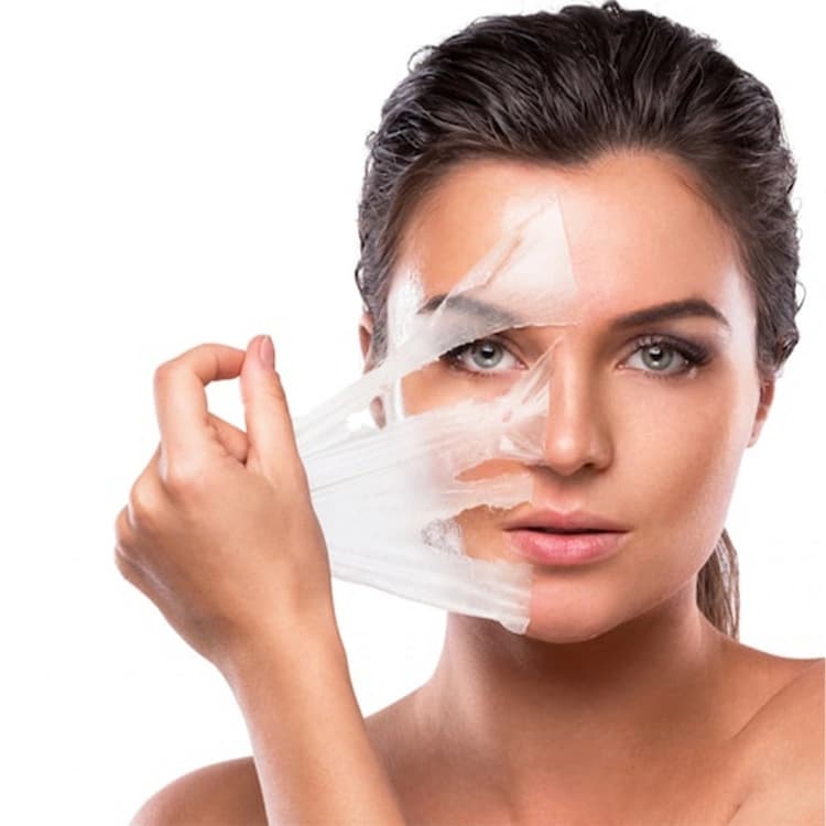 علاج حب الشباب وآثاره